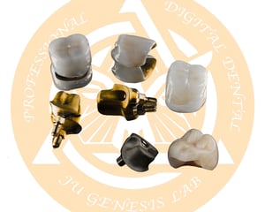custom Abutment1