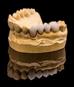ceramic-dentures-2023-11-27-05-05-40-utc-3-2