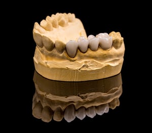 ceramic-dentures-2023-11-27-05-05-40-utc-3